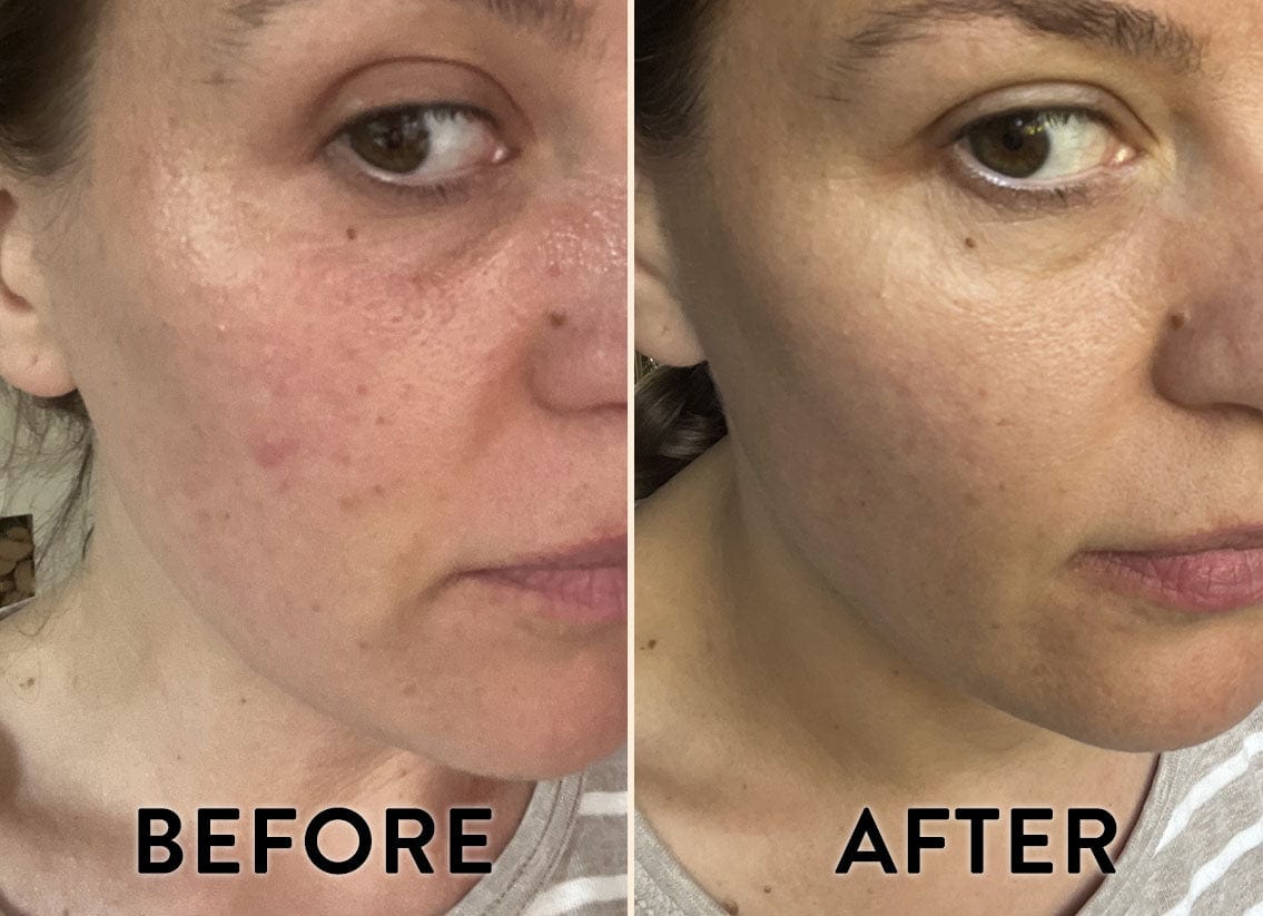 Face Oil Before & After