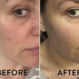 Face Oil Before & After